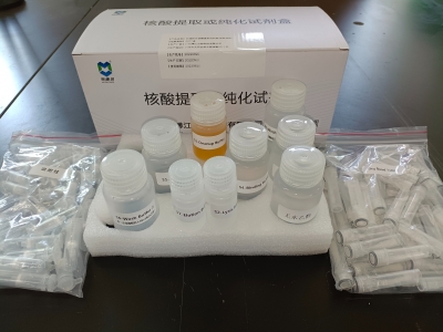 環(huán)境核酸提取柱提法